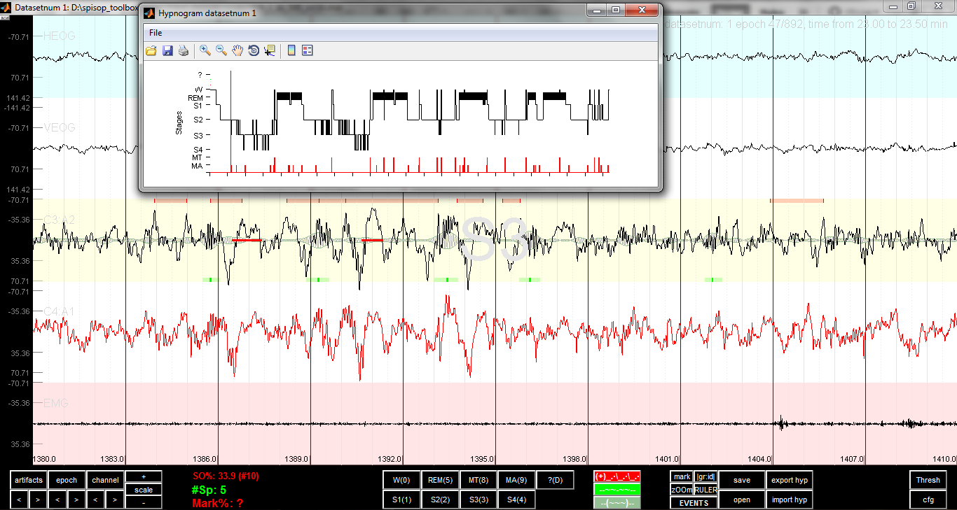 browser_with_hypnogram