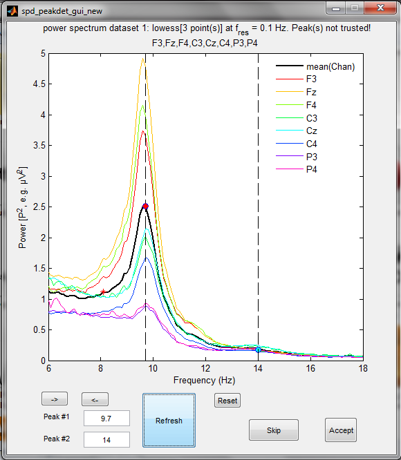 freqpeaks_dominant_slow_peak