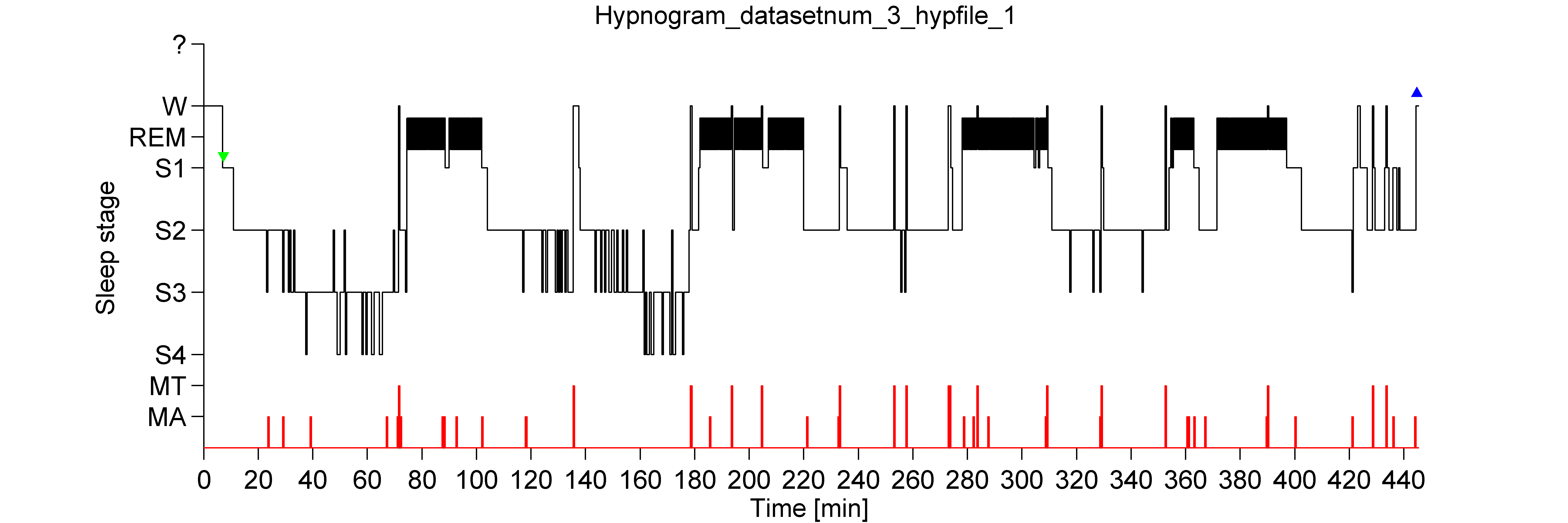 hypnogram_generated